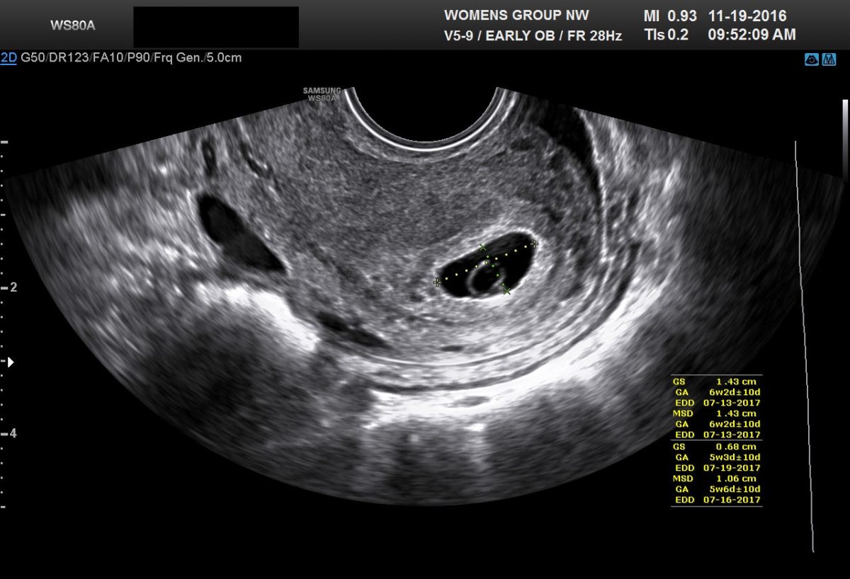 Five common errors made by abortion critics